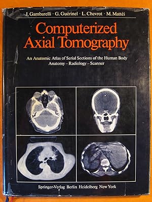 Computerized Axial Tomography: An Anatomic Atlas of Serial Sections of the Human Body. Anatomy, R...