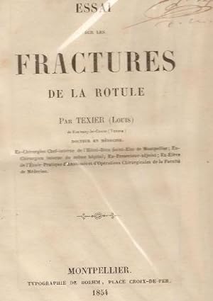 Essai Sur Les Fractures De La Rotule