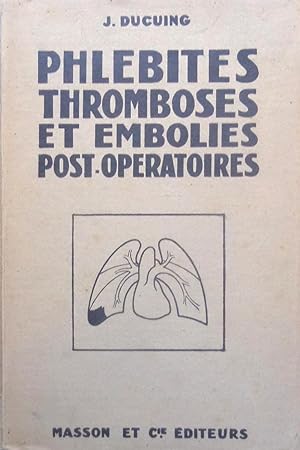 Phlébites, Thromboses et Embolies post-opératoires