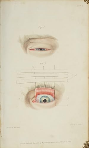 Lectures of the Operative Surgery of the Eye: Being the substance of that part of the author's Co...