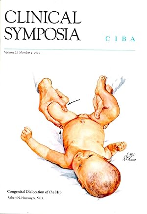 Clinical Symposium Volume 31 Number 1 1979: Congenital Dislocation of the Hip