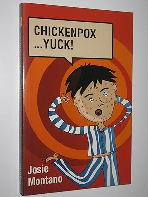 Chickenpox .Yuck!