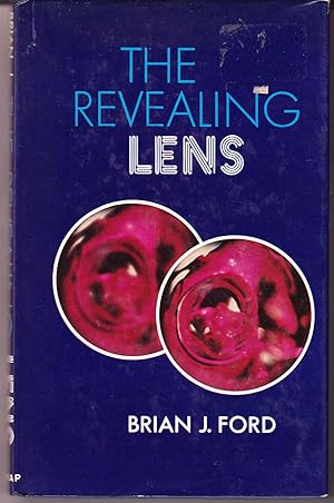 The Revealing Lens: Mankind and the Microscope