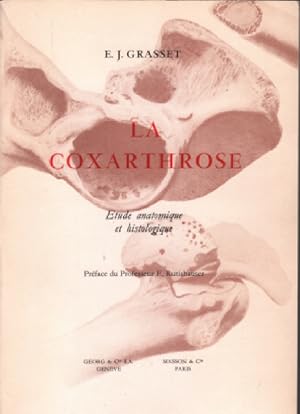 La coxarthrose/ etude anatomique et histologique
