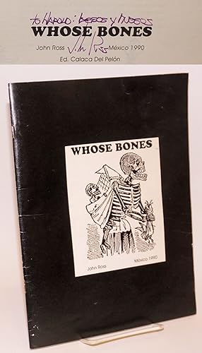 Whose bones