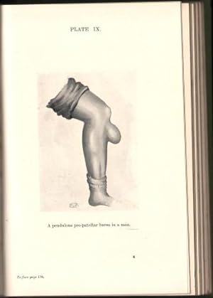 Injuries and Diseases of the Knee-Joint Considered from the Clinical Aspect.