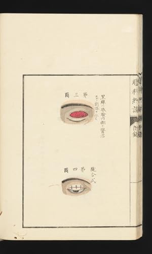 Ganka yakusetsu [trans.: Summary of Ophthalmology]