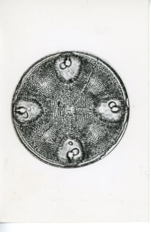 Diatomée Aulacidiscus