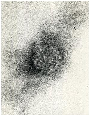 Polyoma Virus