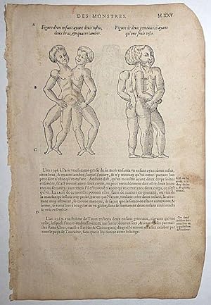 16th-century leaf with four illustrations of conjoined twins from Ambroise Paré's Monsters