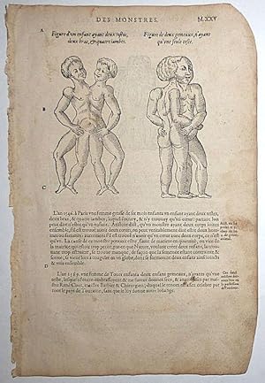 16th-century leaf with four illustrations of conjoined twins from Ambroise Paré's Monsters