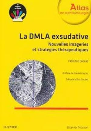 stratégies thérapeutiques dans la DMLA exsudative