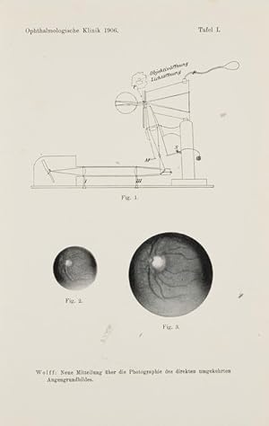 Neue Mitteilung über die Photographie des direkten umgekehrten Augengrundbildes.