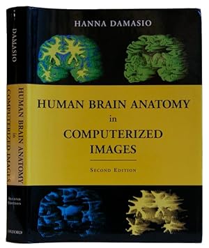Human Brain Anatomy in Computerized Images