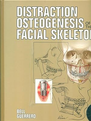 Distraction Osteogenesis of the Facial Skeleton (With CDROM)