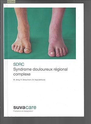 SDRC, Syndrome douloureux régional complexe