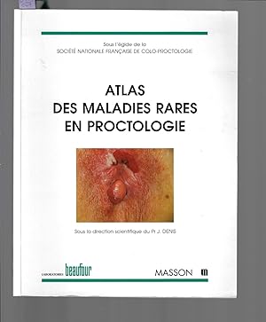 Atlas des maladies rares en proctologie