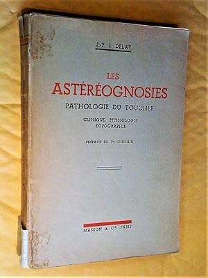 Les Astéréognosies: pathologie du toucher: clinique, physiologie, topographie