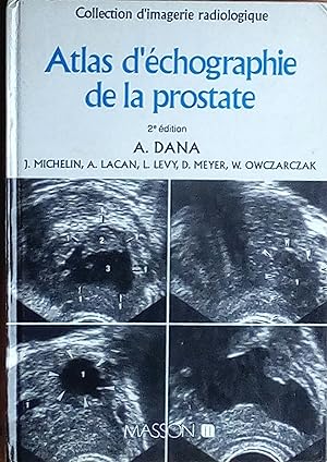 Atlas d'échographie de la prostate