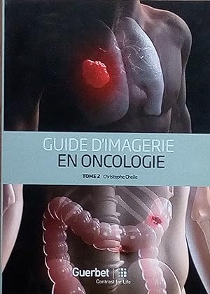 Guide d'imagerie en oncologie Tome 2