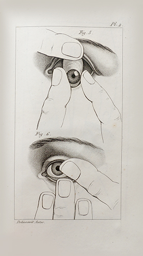 Traité pratique de l'oeil artificiel, Ou expériences et observations sur l'art de cacher la diffo...