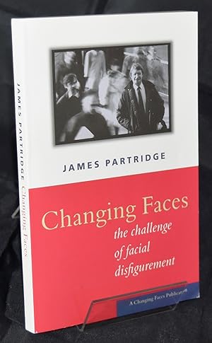 Changing Faces: The Challenge of Facial Disfigurement