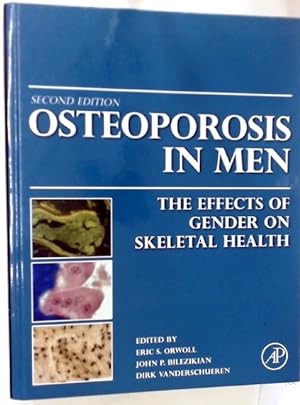 Osteoporosis in Men: The Effects of Gender on Skeletal Health.
