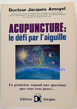 Acupuncture Le Défi par l'aiguille