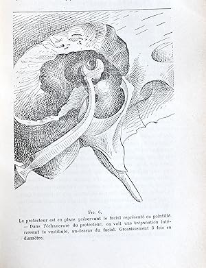 Chirurgie du labyrinthe, In : Annales des maladies de l'oreille et du larynx, 1905, T. XXXI, N° 9.