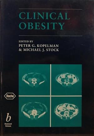 CLINICAL OBESITY.