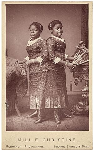 [Photograph of Conjoined Twins]: Millie and Christine