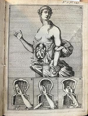 [Medical, midwife, 1691] Spiegel der vroed-vrouwen, behelsende een klaer onderrigt van sware verl...