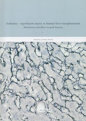 Ischemia : Reperfusion Injury in Human Liver Transplantation : Mechanisms and Effects on Graft Fu...