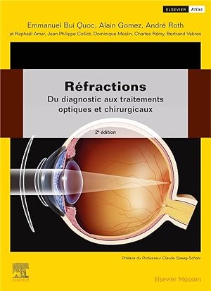 réfractions : du diagnostic aux traitements optiques et chirurgicaux (2e édition)