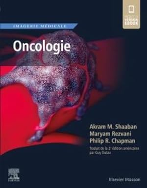 imagerie médicale : oncologie