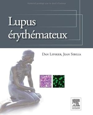 lupus érythémateux