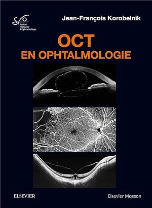 OCT en ophtalmologie