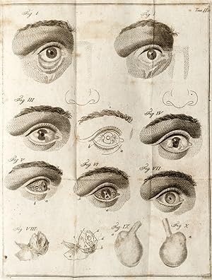 Saggio di osservazioni e di esperienze sulle principali malattie degli occhi. .Tomo Primo (-terzo).