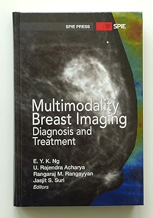 Multimodality Breast Imaging: Diagnosis and Treatment (SPIE Press Monograph)