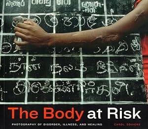 The Body at Risk: Photography of Disorder, Illness, and Healing