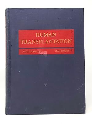 Human Transplantation