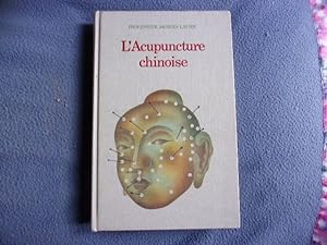 L'acupuncture chinoise