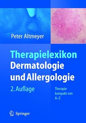 Therapielexikon Dermatologie und Allergologie: Therapie kompakt von A-Z Therapie kompakt von A-Z
