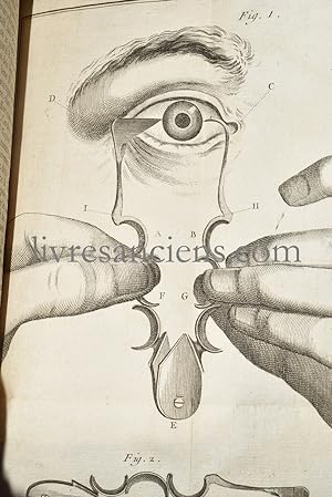 Traité sur les maladies des yeux, dans lequel l'auteur après avoir exposé les différentes méthode...