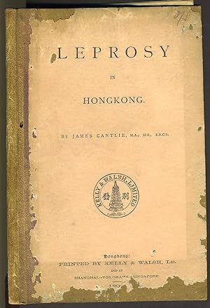 Leprosy in Hong Kong