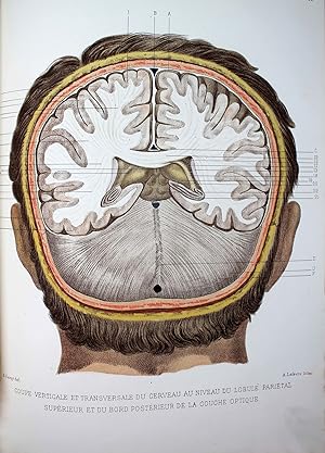 Atlas d'anatomie topographique du cerveau et des localisations cérébrales