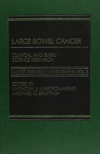 Large Bowel Cancer: Clinical and Basic Science Research