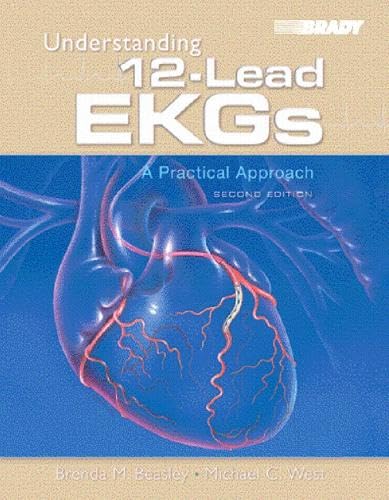 Understanding 12-Lead EKGs: A Practical Approach