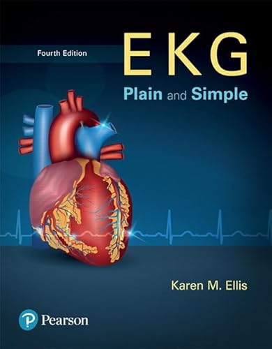 Ekg Plain+simple