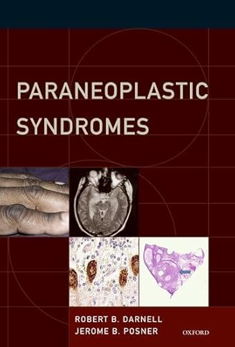 Paraneoplastic Syndromes (Contemporary Neurology Series, 79)